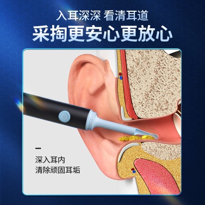 为伴 可视挖耳勺掏耳勺掏耳朵神器儿童发光挖耳勺高清无线内窥镜工具套装安卓苹果通用 炫酷黑