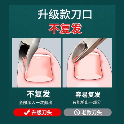 忍者（storc）修脚刀甲沟炎专用指甲刀指甲钳指甲剪套装全套修脚神器 九件套